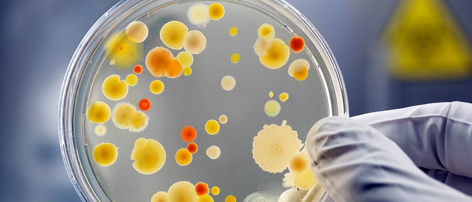 Gloved hand holding petri dish with orange and yellow bacteria