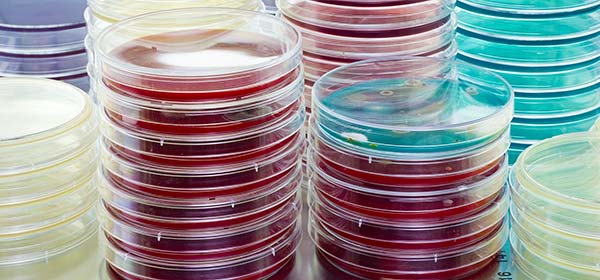 Petri dishes in the microbiology lab at Hohenstein Medical